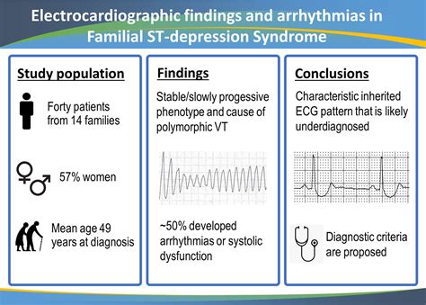 Inferior St Depression Ekg