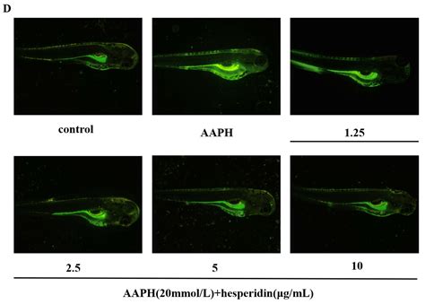 Hesperidin Anti-Osteoporosis by Regulating Estrogen Signaling Pathways