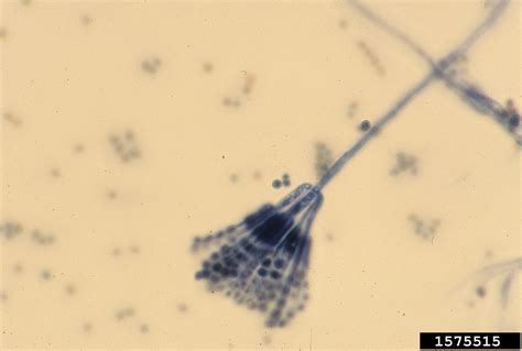 Penicillium Under Microscope 100x
