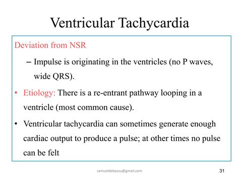 3. common cardiac arrythemias | PPTX