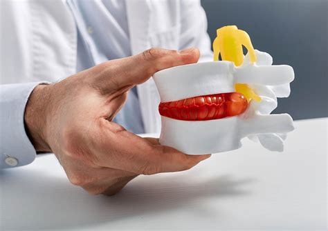 Image result for Lumbar Disc Injection