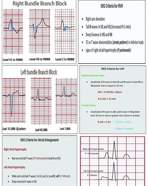 Image result for ECG Normal Values