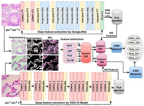 Histopathological Analysis for Detecting Lung and Colon Cancer ...