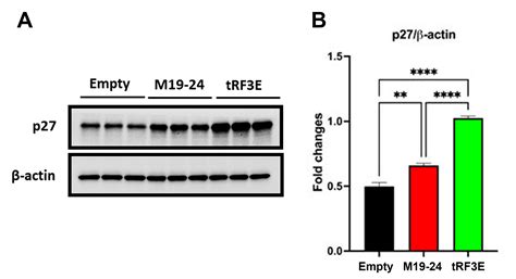 Dissecting the tRNA Fragment tRF3E–Nucleolin Interaction: Implications ...