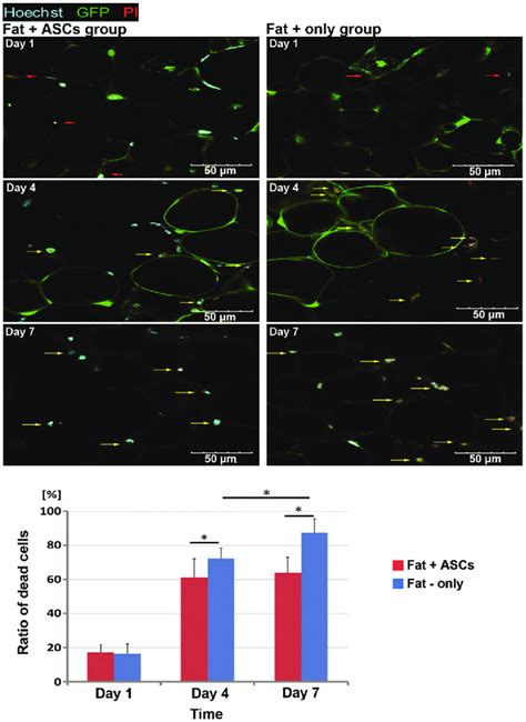 Image result for Deep Tissue Pi