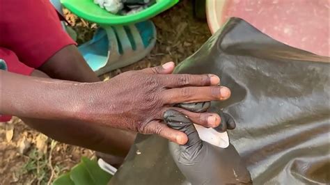 Jigger Fleas Remove 的图像结果