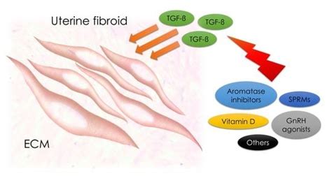 Role of Transforming Growth Factor β in Uterine Fibroid Biology