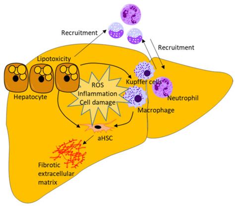 Hepatic Stellate Cell Activation and Inactivation in NASH-Fibrosis ...
