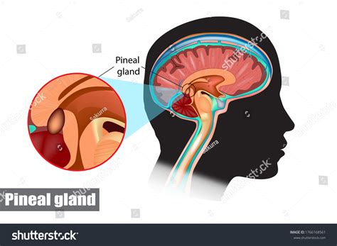 Pineal Gland Disorders