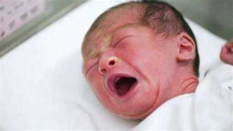 刚出生26天的男宝宝，尿尿是“分叉的”，送医院医生脸都白了_腾讯视频