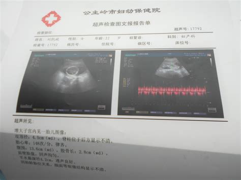怀孕50天B超图显示如下，孕囊一般是三个数据，至少也两个，为何该医院只给出一个？ - 百度宝宝知道