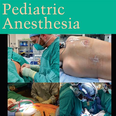 Pediatric Anesthesia 的图像结果