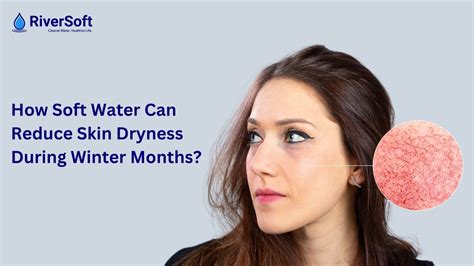 How Soft Water Can Reduce Skin Dryness During Winter Months - Riversoft