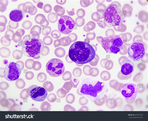 Hematology Society HS Blood Cells In Peripheral Blood Smear, 49% OFF
