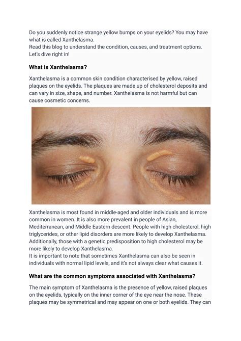 Cholesterol Bumps On Eyelids