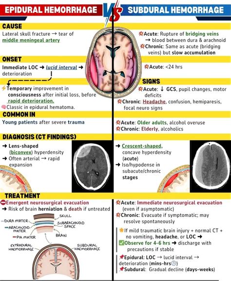 EPIDURAL vs SUBDURAL HEMORRHAGE | Dr. Jayati paul