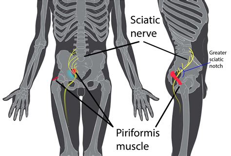 High Hamstring Tendinopathy