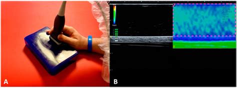 Applied Sciences | Special Issue : Advances in Imaging Techniques for ...