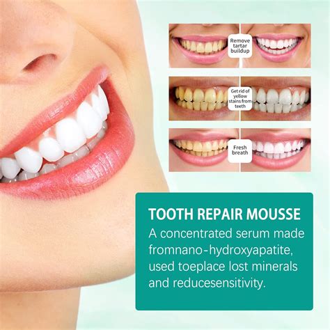 Buy 3 Pcs Teeth Whitening Mousse Foam Toothpaste, Ultra-fine Mousse ...