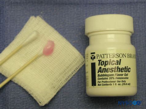 Surface Anesthesia 的图像结果