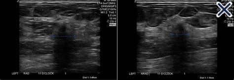 11th Harmonic Cancer 的图像结果