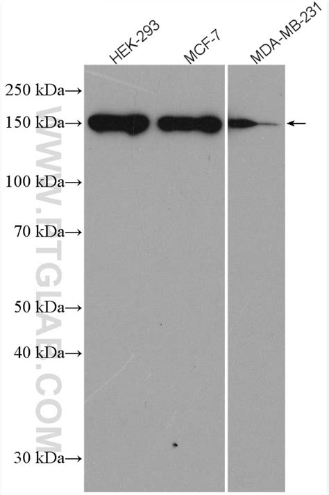GLI1 antibody (66905-1-Ig) | Proteintech