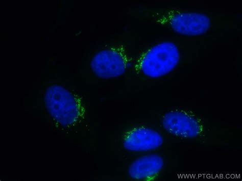 GOLGA2/GM130 antibody (CL488-11308) | Proteintech