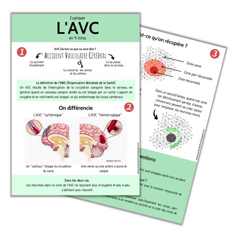 Image result for AVC Video Explicative