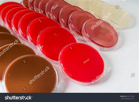 Blood Agar Media