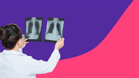 Left Rib Cage Pain Causes Left Rib Cage And Back Pain: Your Guide To