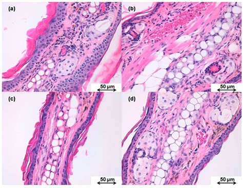 Polymeric Nanoparticles and Chitosan Gel Loading Ketorolac Tromethamine ...