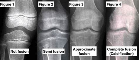 Image result for Appendix with Screen Shot Example