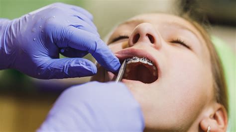 Remove Brackets 的图像结果