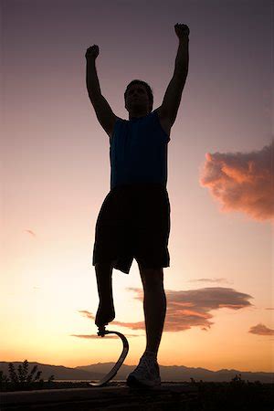 Prosthetic and Orthotics Department | Prosthetists | Orthotics Treatment