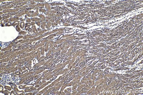 IHCeasy RIPK2 Ready-To-Use IHC Kit KHC2086 | Proteintech