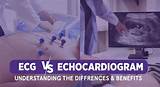 ECG vs. Echocardiogram: What’s the Difference? – MyDiagnostics