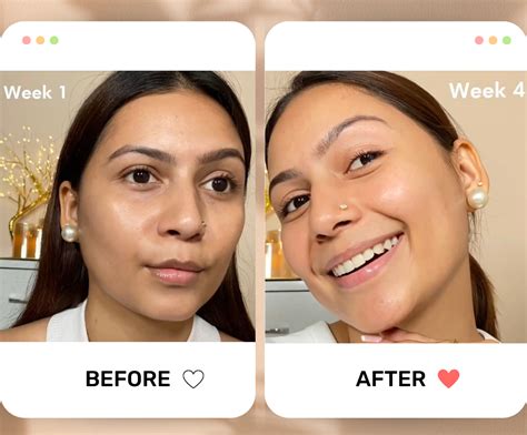 #1 Face Serum For All Your Skin Concerns + FREE Face Roller – Moraze ...