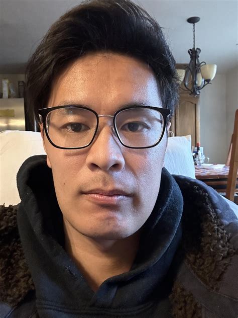 2 weeks Post Op: Double Jaw Surgery and Genioplasty : r/jawsurgery