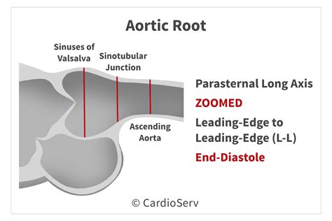 Aortic Root
