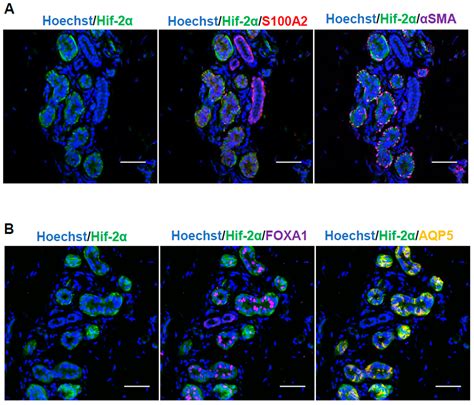 Long-Term Hypoxia Upregulates Wnt and TGFβ1 Signaling in Eccrine Sweat ...
