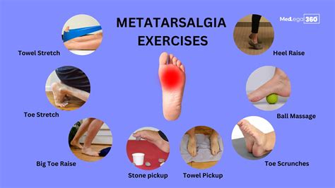 10 Best Metatarsalgia Exercises to Relieve Your Foot Pain
