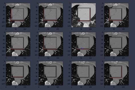 Image result for Resnet34 Architecture for Image Classification Using Numpy