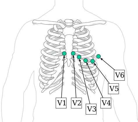 Ecg Electrode Locations at Marvin Wolbert blog