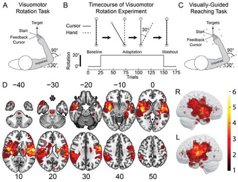 Movement Impairments May Not Preclude Visuomotor Adaptation After Stroke