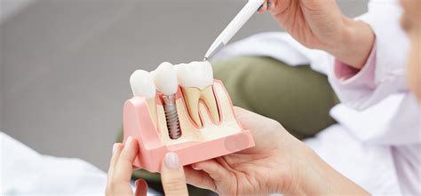 Dental Implant Treatment in Bilaspur | Dental Implant Cost in Bilaspur