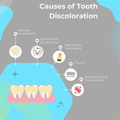 Different Types of Tooth Discoloration & Their Causes — KWC Dental