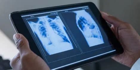 Step Forward | Des Kidd, M.D., SMO radiologist, Taranaki District ...