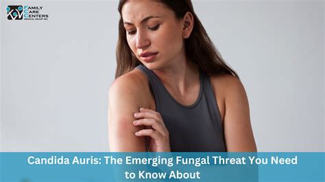 Candida Auris: The Emerging Fungal Threat You Need to Know About