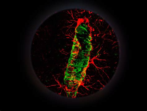 Image result for Brain Under Microscope