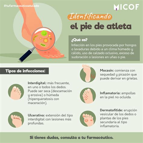 Pie De Atleta Receta Casera at Brooke Plume blog